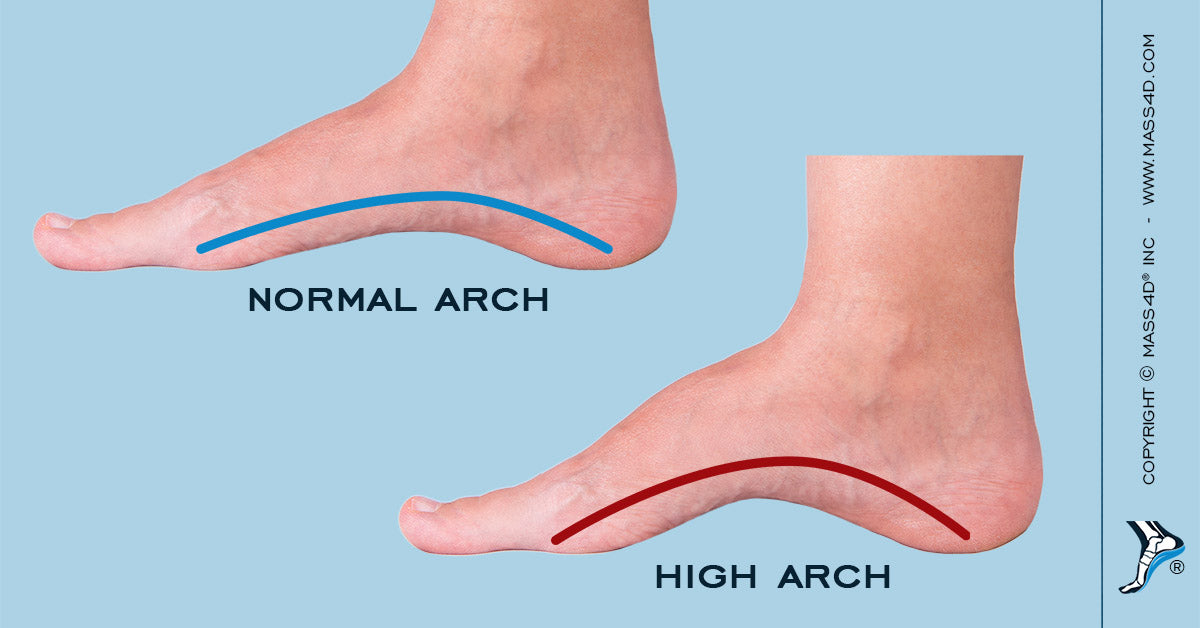 extra high arch insoles