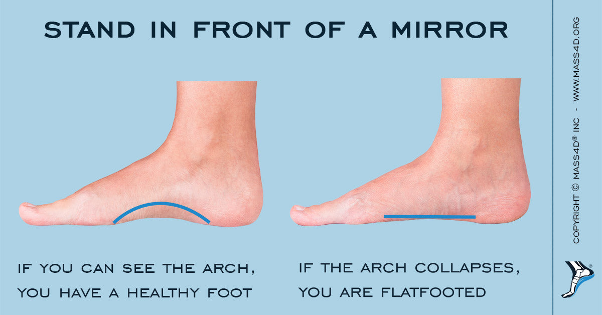 What is Plantar Fasciitis? MASS4D® Foot Orthotics