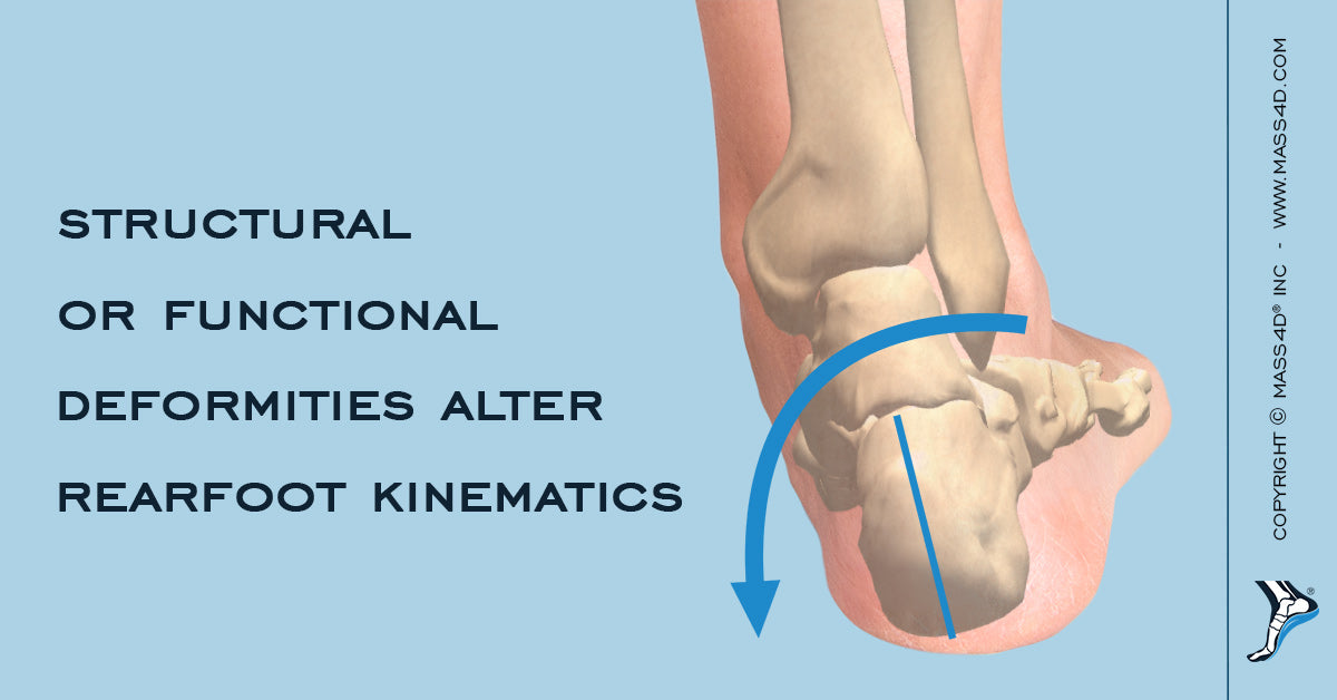 Can Insoles Really Cause Back Pain? - MASS4D® Foot Orthotics