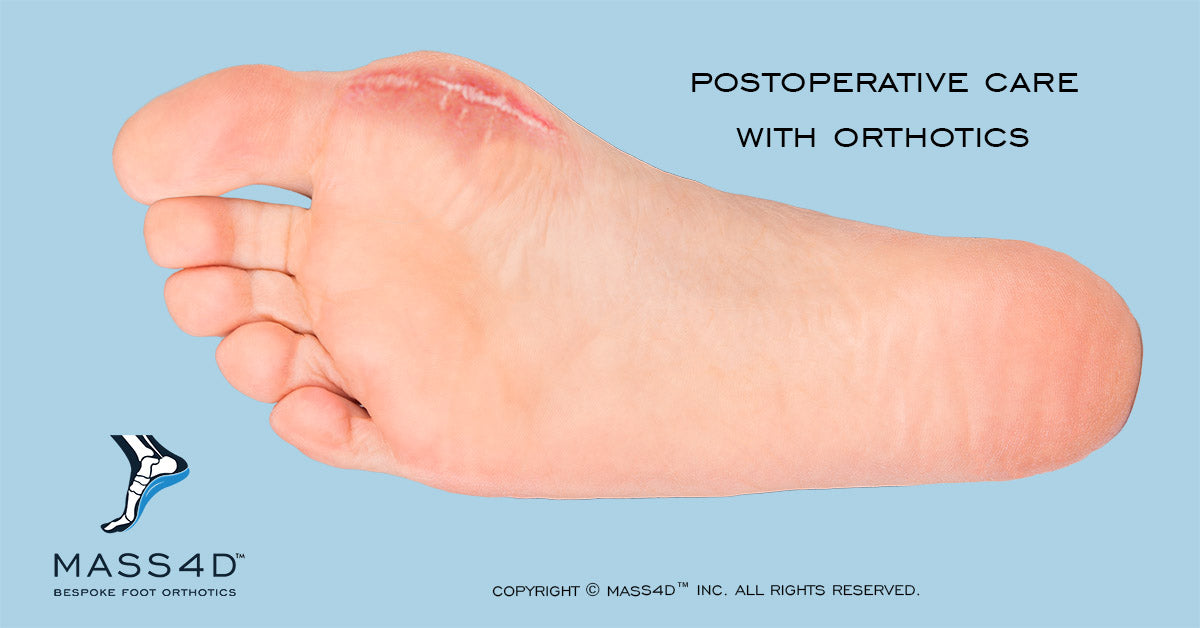 Orthotics for Postoperative Care 