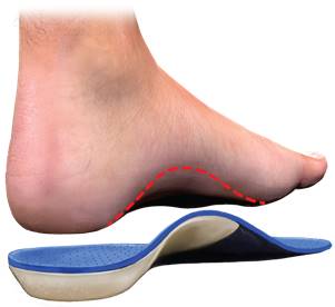 Image result for orthotic
