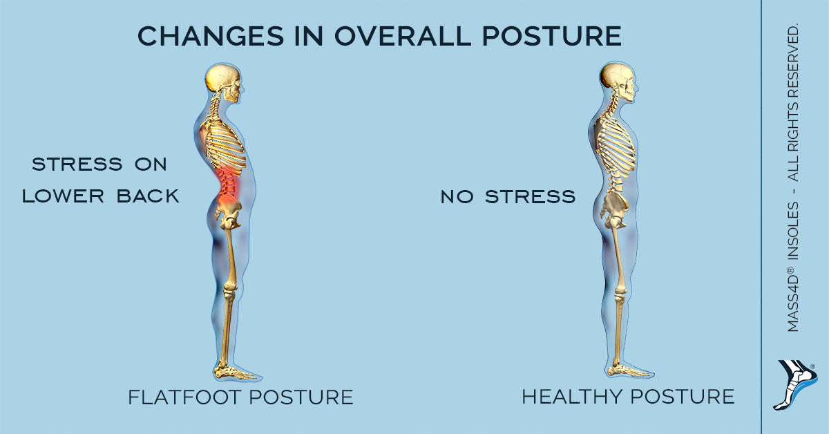 posture insoles