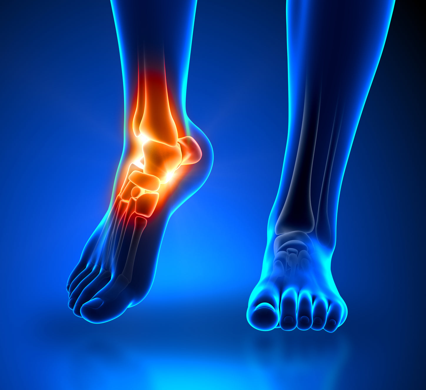 insoles for ankle pain