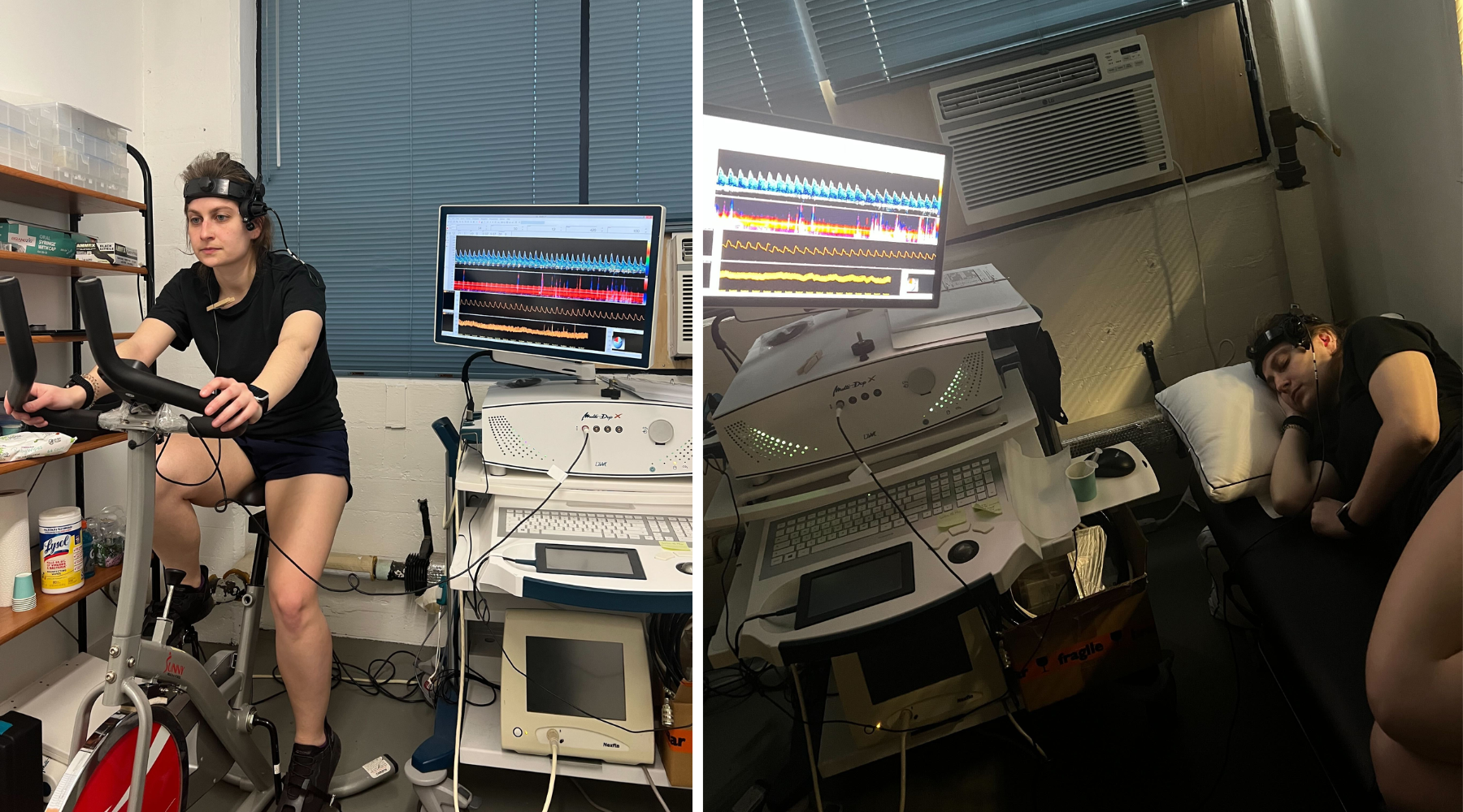 Milena Quinci TCD Blood Flow CBF Cerebral Blood Flow POTS
