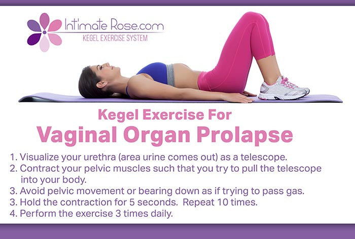Vaginal Pelvic Organ Prolapse Exercises Intimate Rose