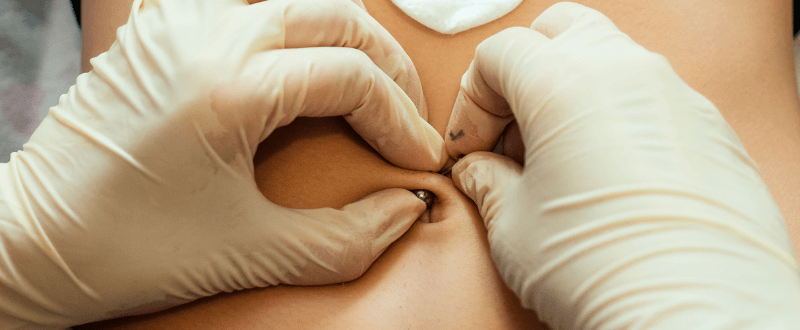 The belly button piercing procedure