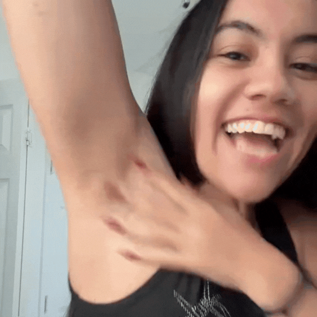 Applying Pigment Repair & Collagen Boost Jelly on body dark spots for even tone