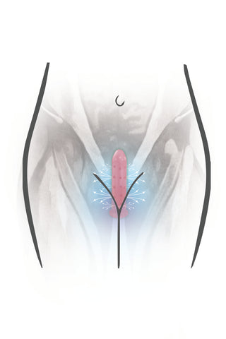 dilator inserted properly