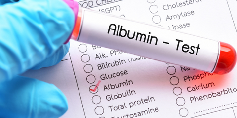 Albumin blood test