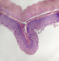 Intestinal Mucosa