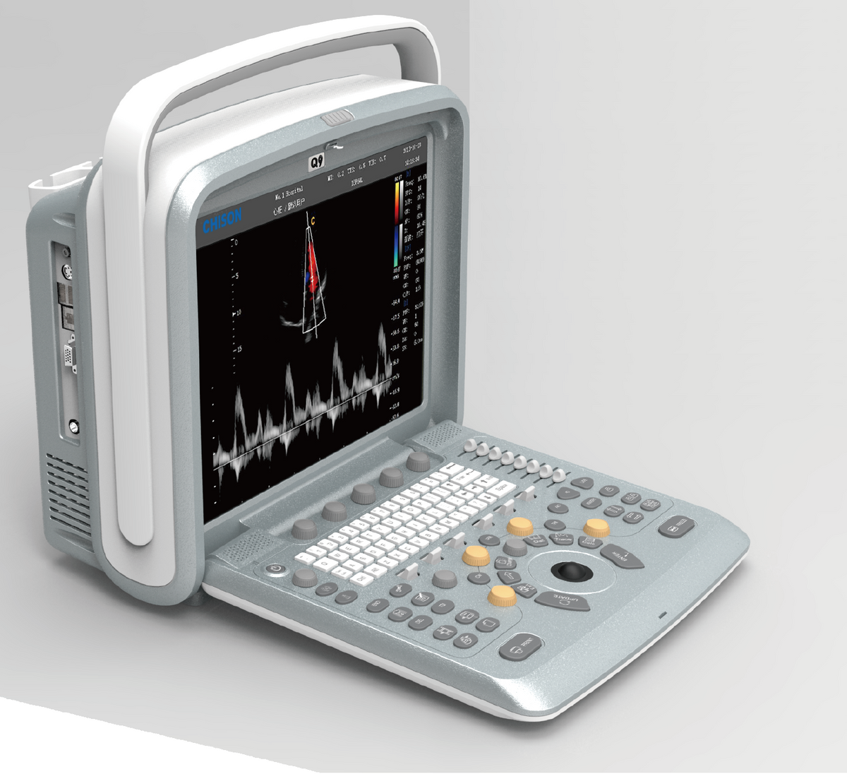 sonogram machine