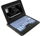 Digital Portable Ultrasound Machine Laptop Scanner with Convex Probe,US shipping 6945040100362