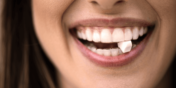 How to Tell if Your Invisalign Trays Fit Correctly – Movemints