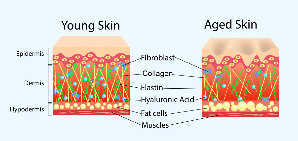 Cross section of skin diagram - collagen, hyaluronic acid, dermis, epidermis