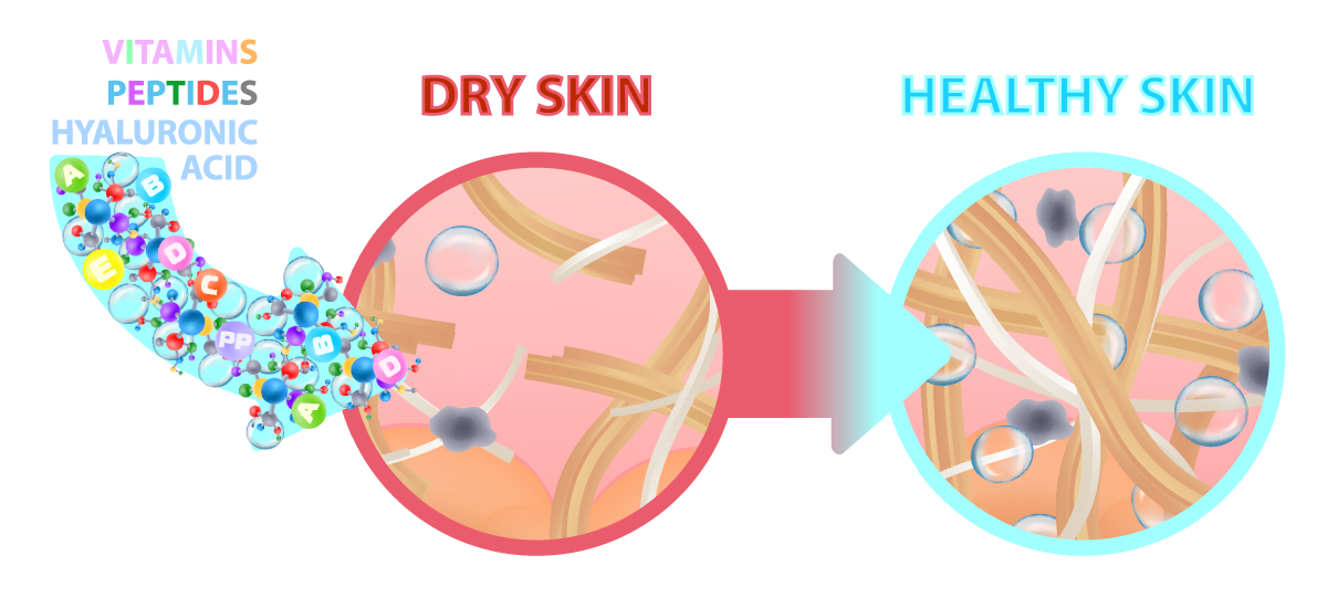 Dry Skin Healthy Skin