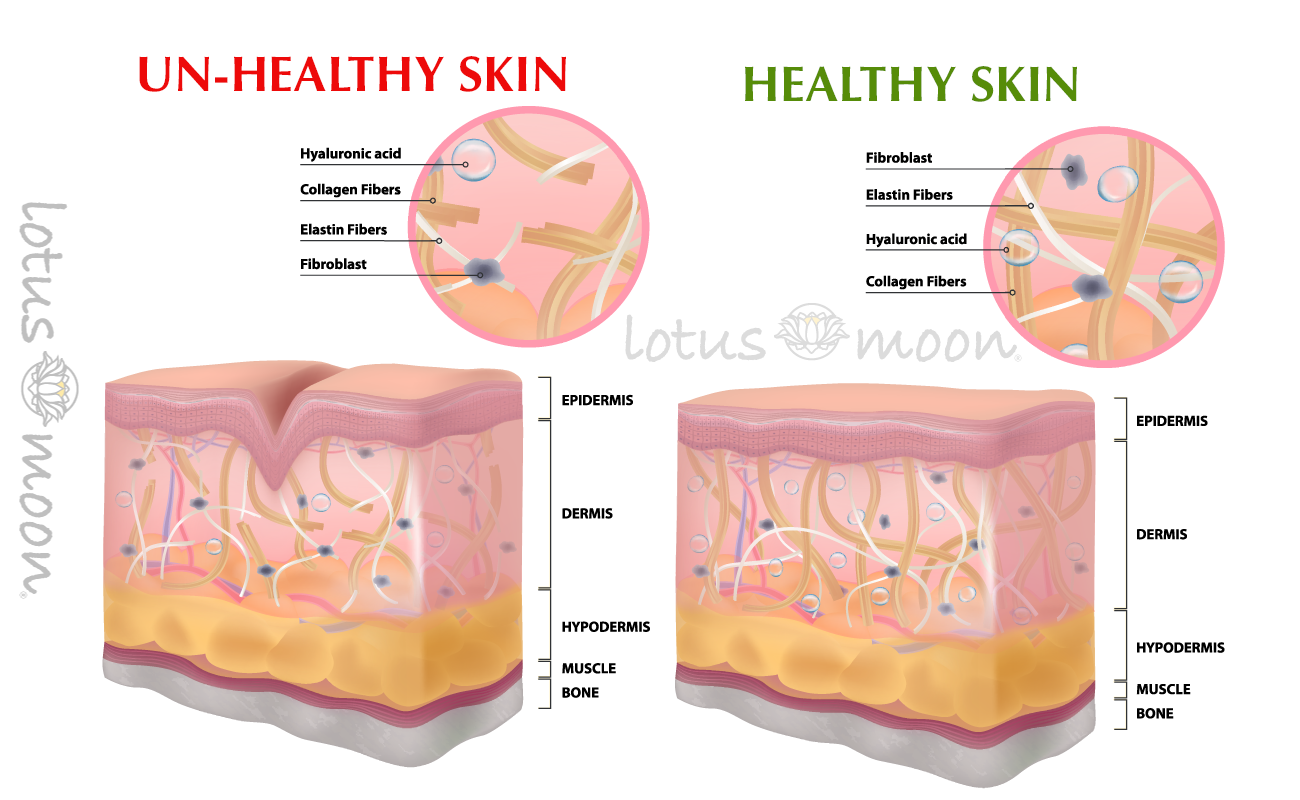 Healthy skin versus unhealthy skin