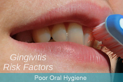 gingivitis