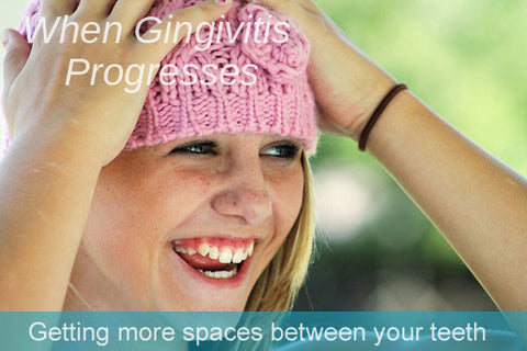 gingivitis