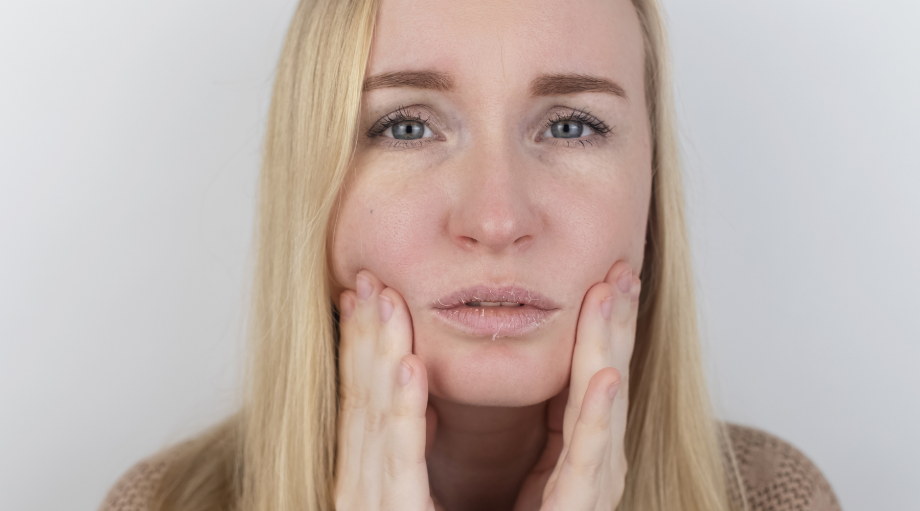 Women with Rosacea querying the triggers of her symptoms