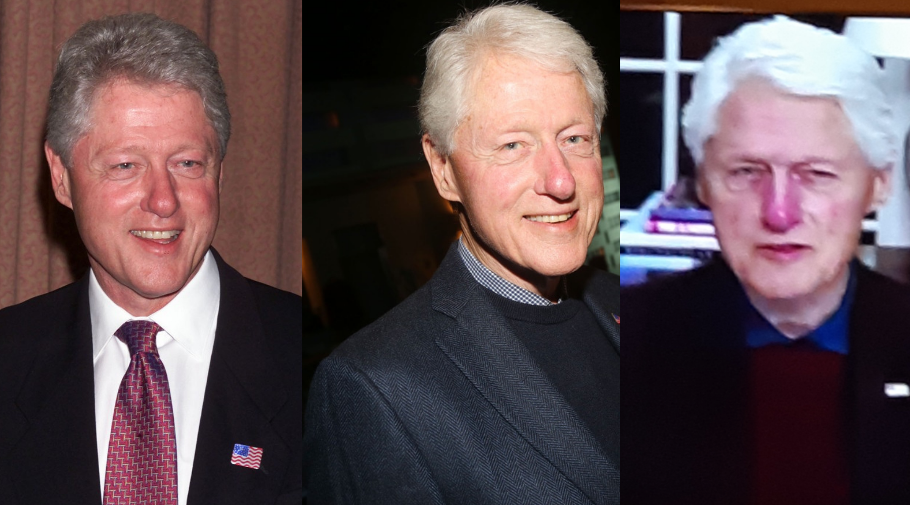 The image shows three photographs of the American ex President Bill Clinton face over a decade. In each photograph redness is visible. 