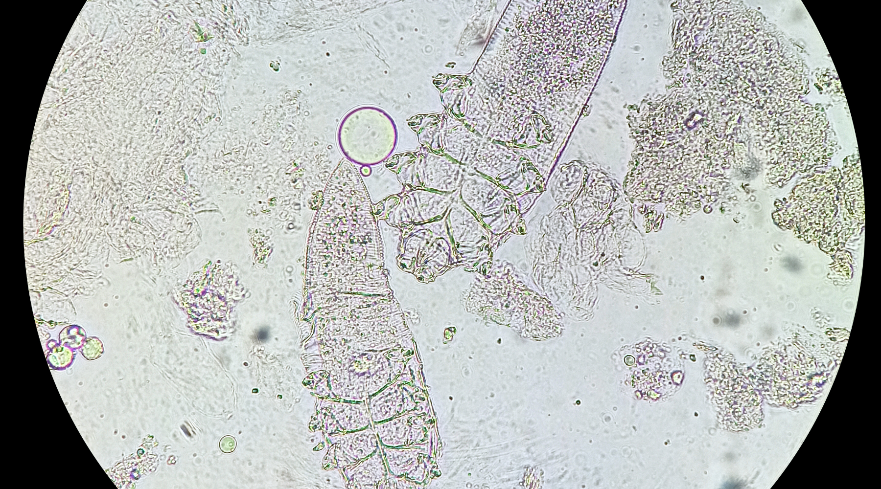 Microscopic image of the demodex mite