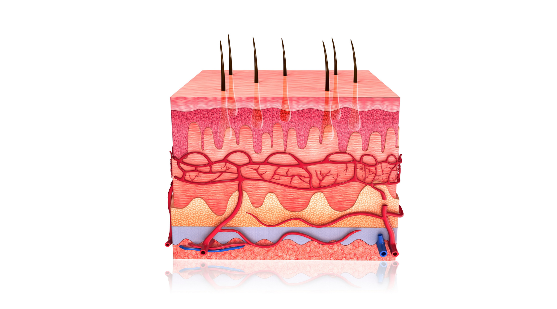 Cross section of skin to represent the cellular triggers that cause Rosacea