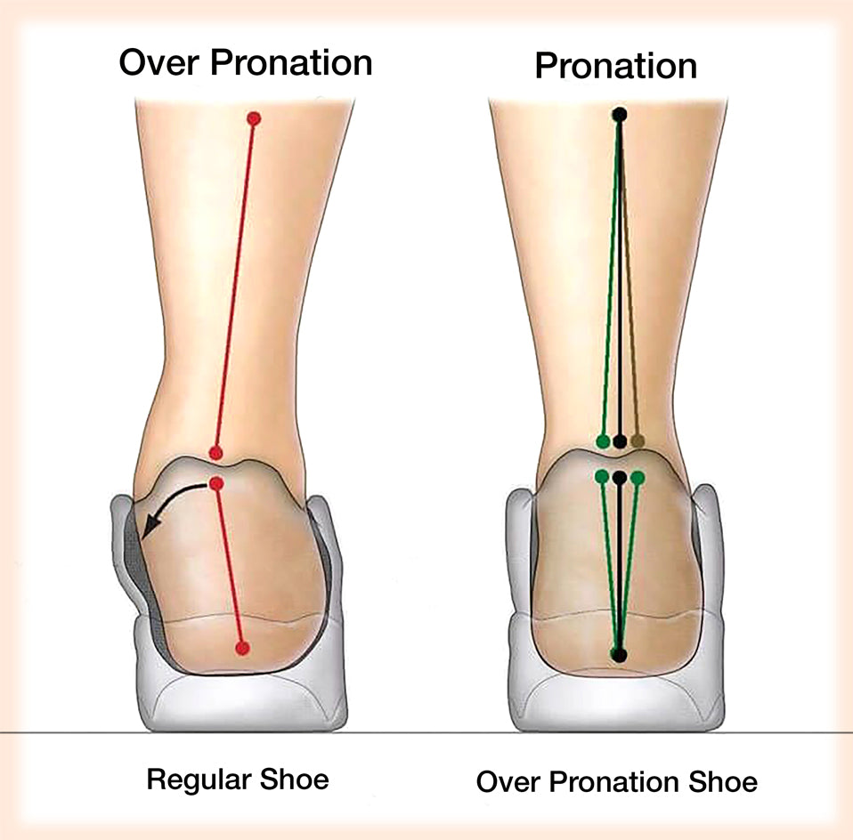 dress shoes for flat feet pronation
