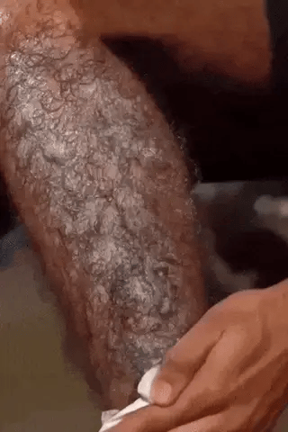 Ecrin Fast Hair Removal Action