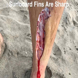 Surfboard Fin Laceration - Skeg Cut - Surfing Medicine - surfer injury - surfing medicine international
