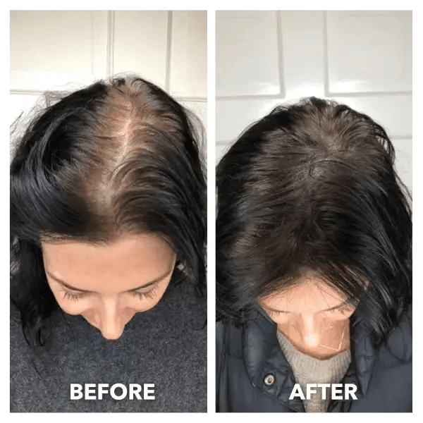 HaarLuma Before and After Results