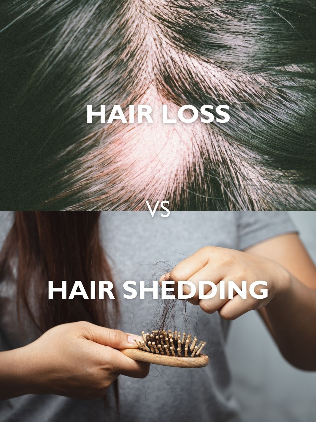 How Much Hair Loss Is Normal? – The Olive Tree