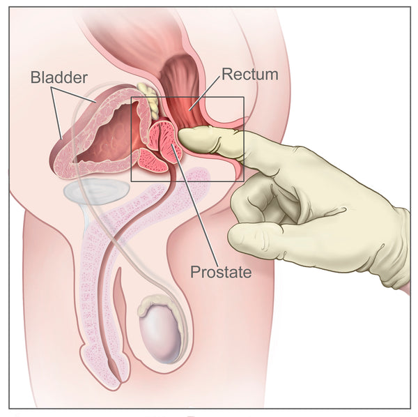 prostate milking massage