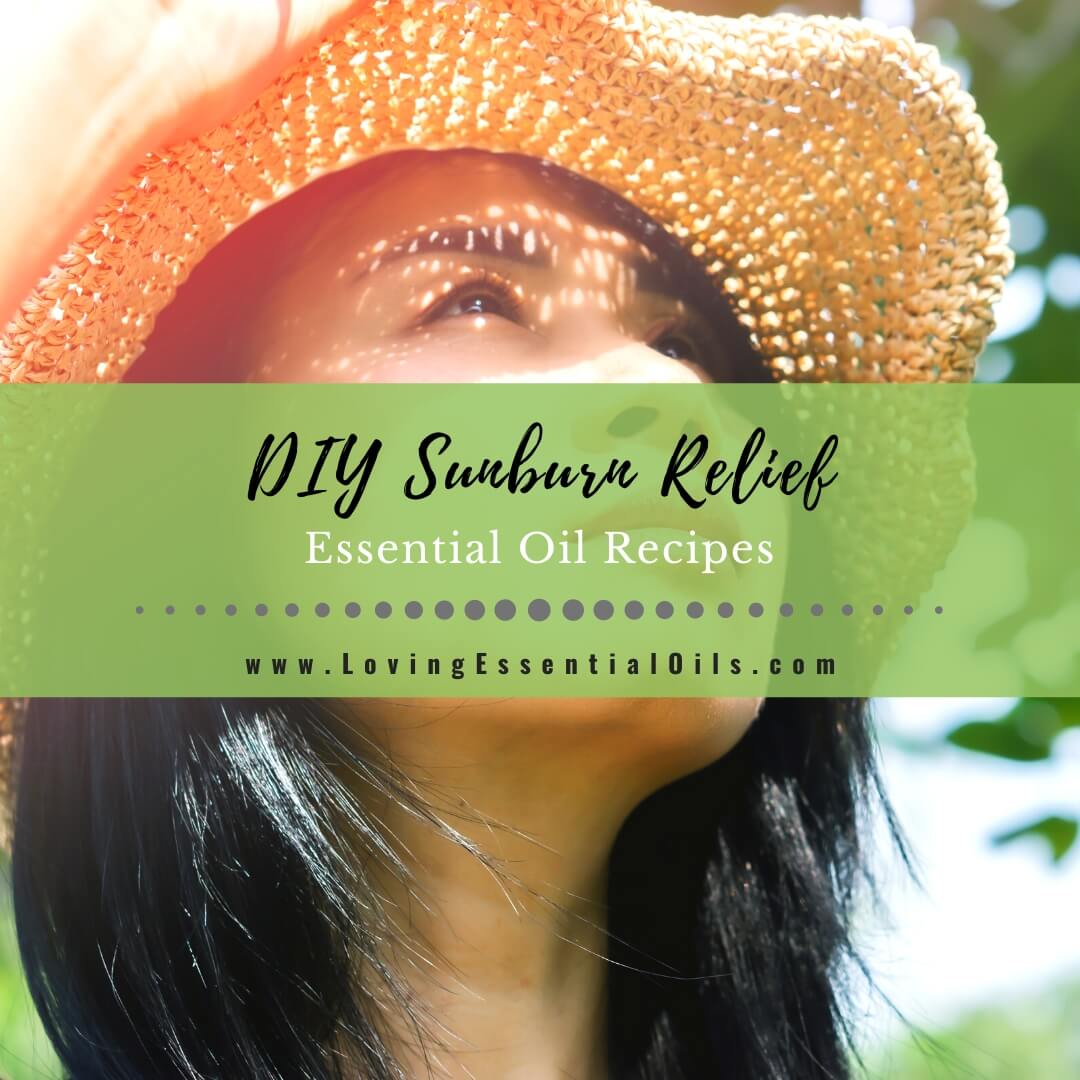 2 Natural Sunburn Relief Spray Recipes - Simple Life Mom