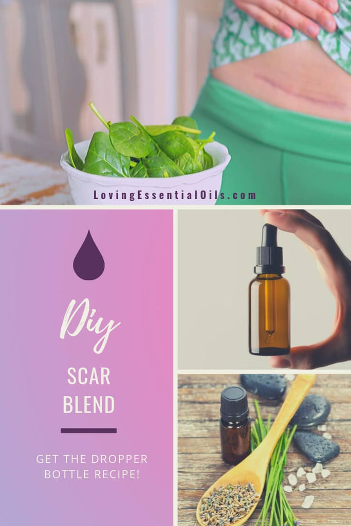 Best Oil for Scars with DIY Recipes by Loving Essential Oils