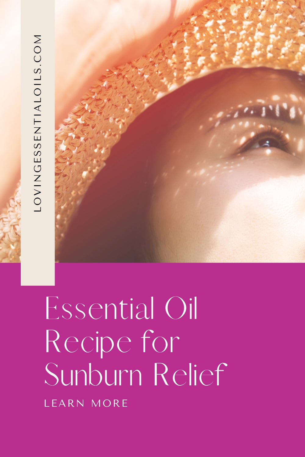 Sunburn Relief Essential Oil Recipe by Loving Essential Oils