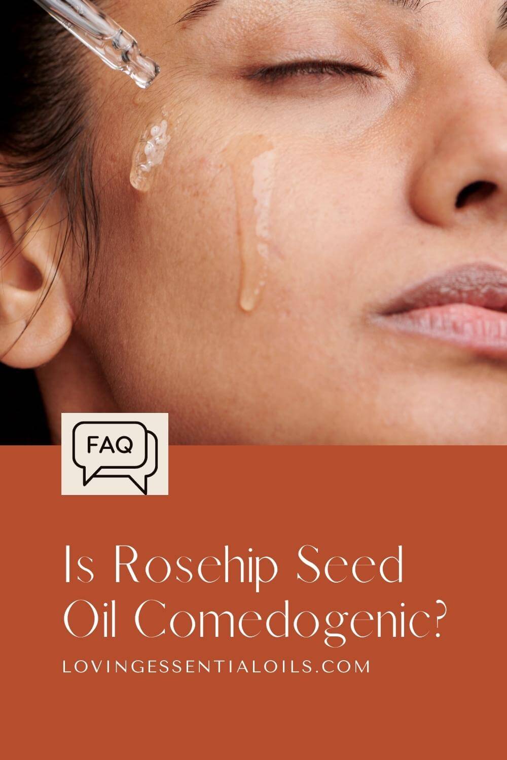 Rosehip Seed Oil Comedogenic Rating by Loving Essential Oils