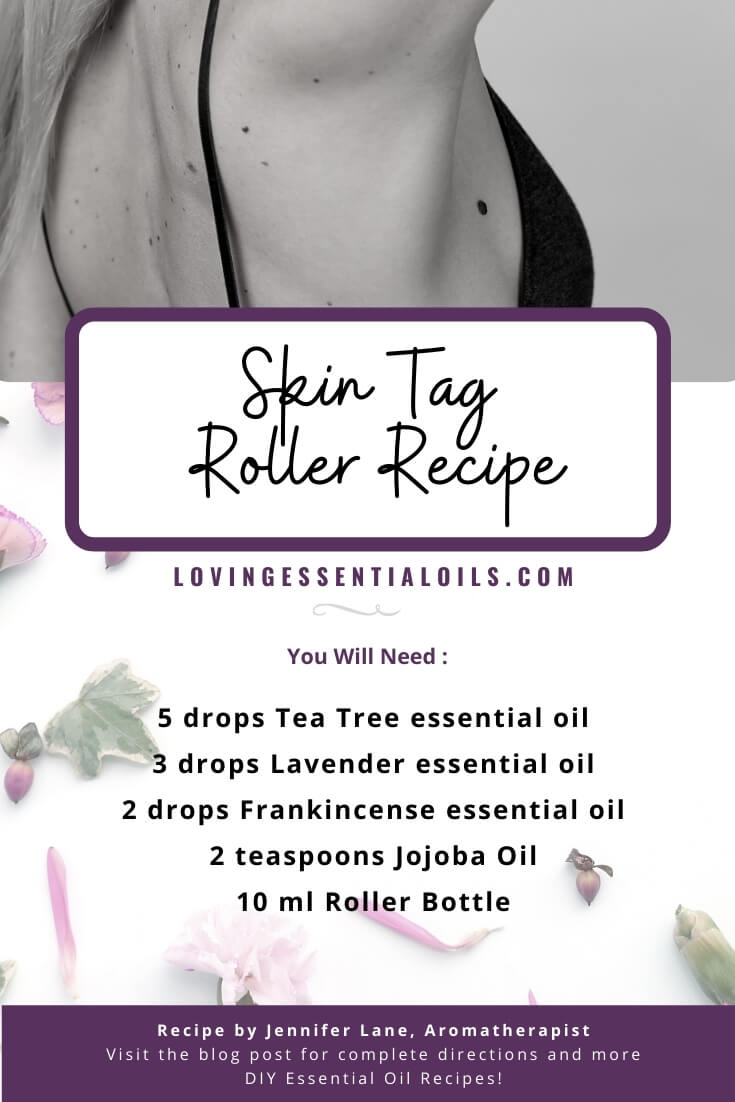 Skin Tag Essential Oil Roller Recipe by Loving Essential Oils