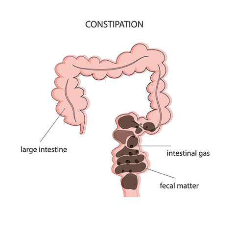 incontinence constipation