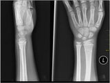 Request an appointment for an X-ray