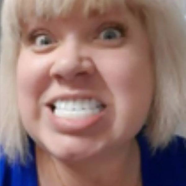 Silicon dentures fitting process