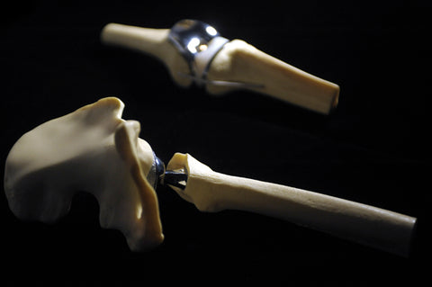 replacement knee part