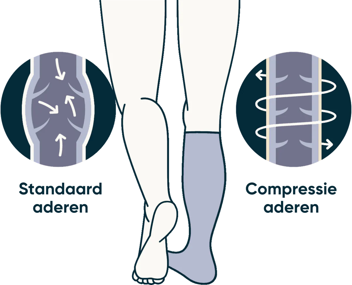 Infographic compressiekousen