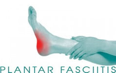 Plantar Fasciitis Treatment