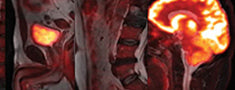 Molucular Imaging