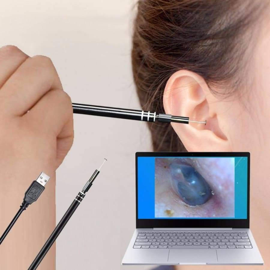 Kit De Nettoyage De Canal Oreille Avec Caméra Endoscope Livraison Gr Storydeals 