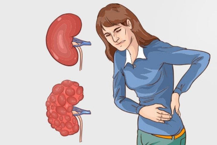 Can gas cause kidney pain?