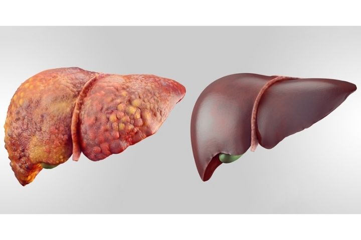 Effects Of Liver Detox