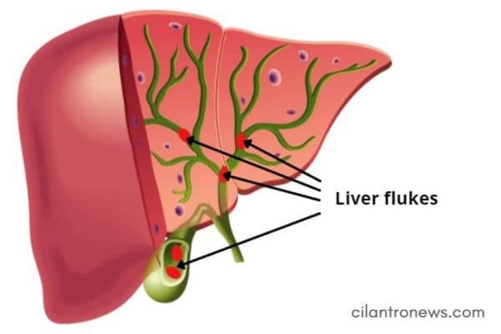 Liver Fluke Cleanse by Cilantro News