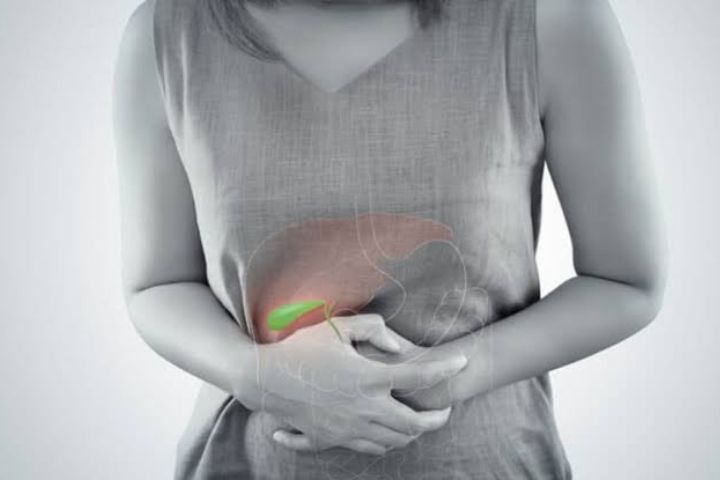 Preventing gallstones and maintaining healthy liver