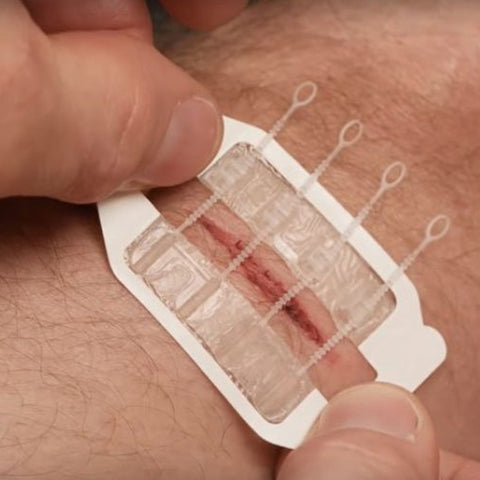 Zipstitch suture